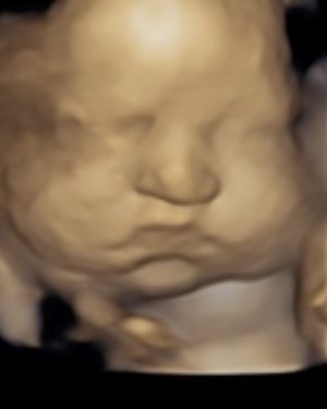 4D Ultrasound Imaging Near Me in Shrewsbury, NJ 4D Ultrasound Imaging Near Me in Shrewsbury, NJ